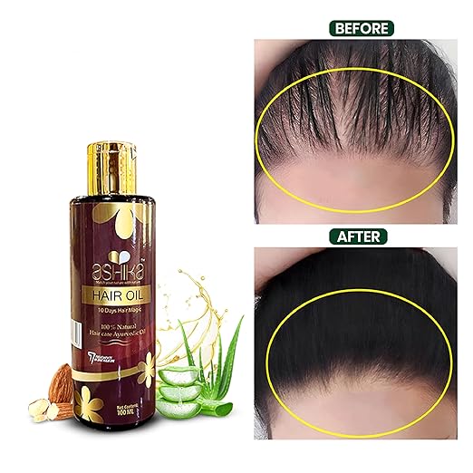 Ashika Ayurvedic Hair Oil for Hair Growth & Hair Fall Control – Natural Herbal Hair Oil for Men & Women 4